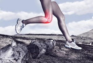 膝關節退化OA knee